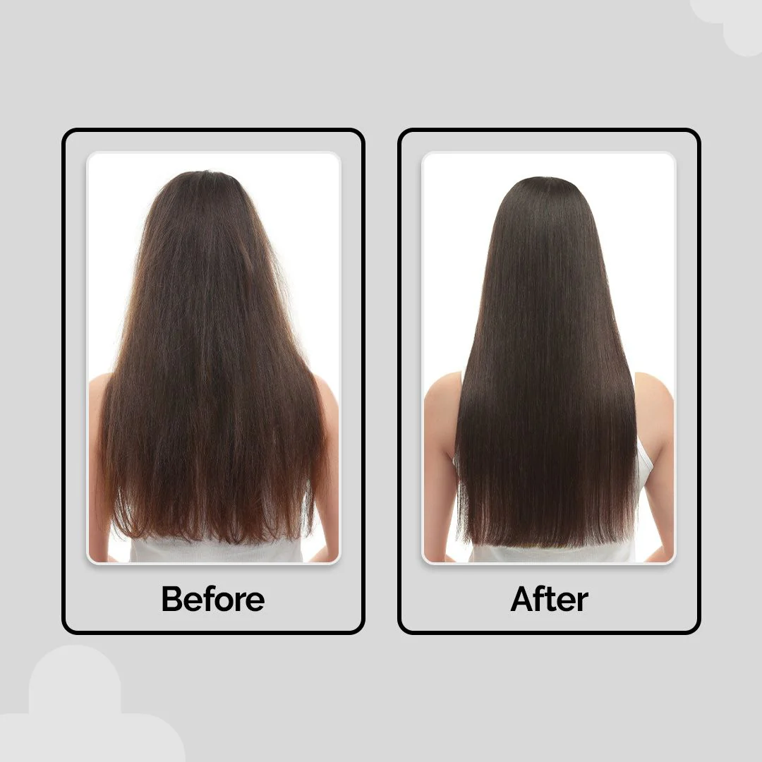 Anti-Hairfall Essentials Duo - Image 7